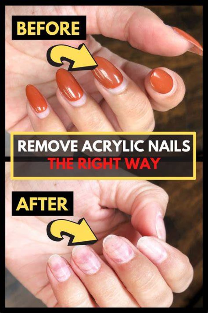 How to Remove Acrylic Nails At Home (With & Without Acetone)
